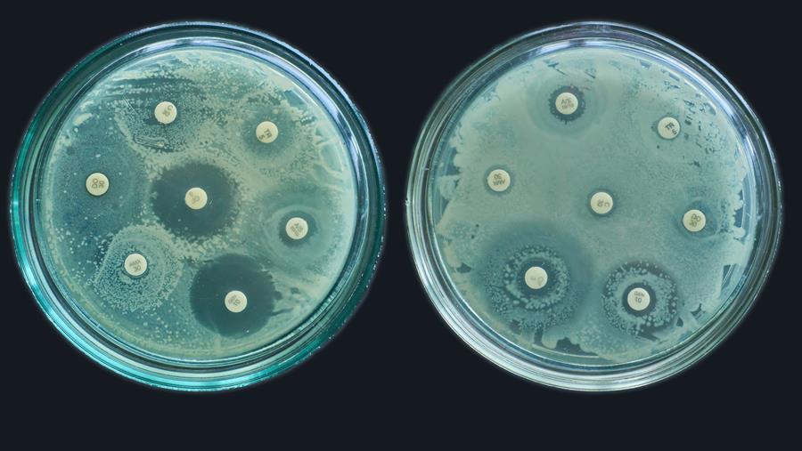 La résistance aux antibiotiques a augmenté de 40 % en cinq ans au niveau mondial (OMS)