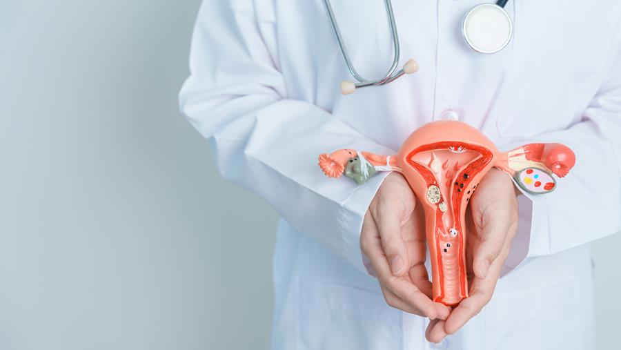 Un antagoniste oral des récepteurs de la GnRH se montre rapidement efficace contre l’hyperménorrhée en présence d’un fibrome